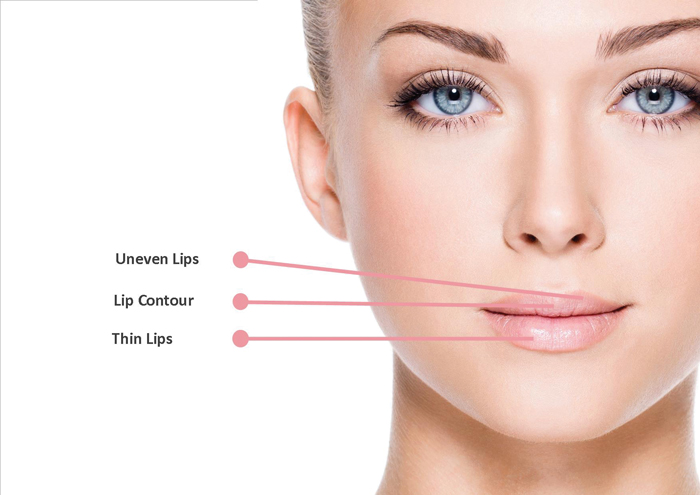 Thin-Lips