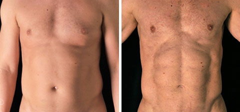 lifemagazinegr_dr_alfredo_hoyos_body